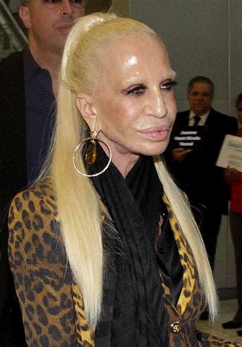 Donatella Versace’s ‘Human Waxwork’ Face: Cosmetic Surgery .